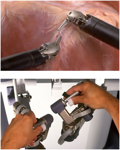 robotik cerrahi sistem