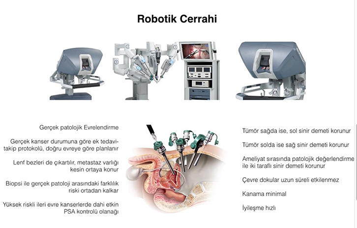 robotik cerrahi 